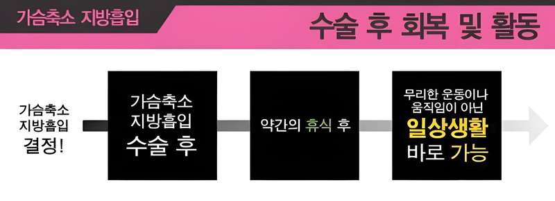 가슴축소 지방흡입 수술 관련 이미지